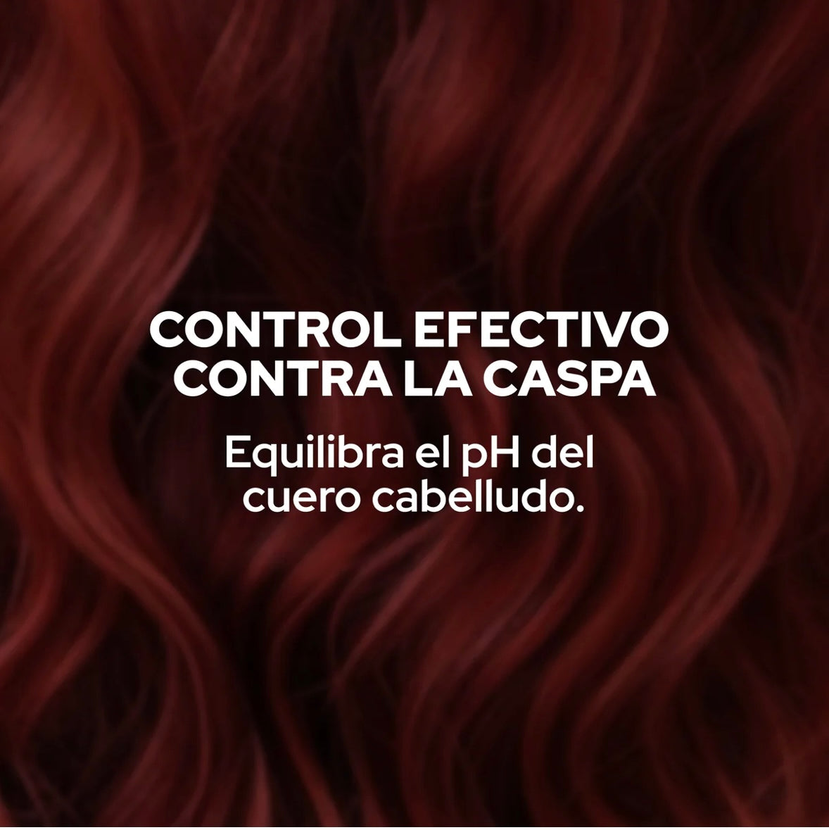 Shampoo anticaspa Anyeluz